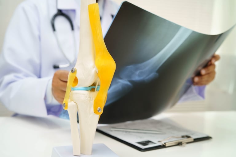 Doctor examining knee joint bone radiography xray film